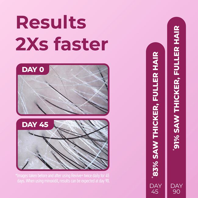 BosleyMD Revive+ Hair Densifying Foam for Women 2.11 oz
